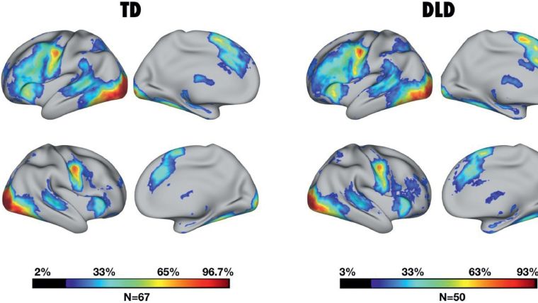 Areas commonly activated in the brain during a verb generation task.  On the left is the image for children who are typically developing and on the right is the image for children with DLD.