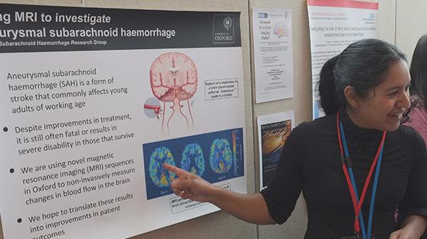 Our group aims to achieve a better understanding of what happens in the brains of patients who have just had a subarachnoid haemorrhage, which is a type of stroke.