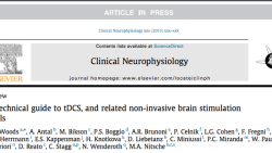 Published Paper: Clinical Neurophysiology